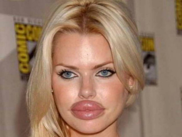 Πλαστικές επεμβάσεις με… τραγικά αποτελέσματα!