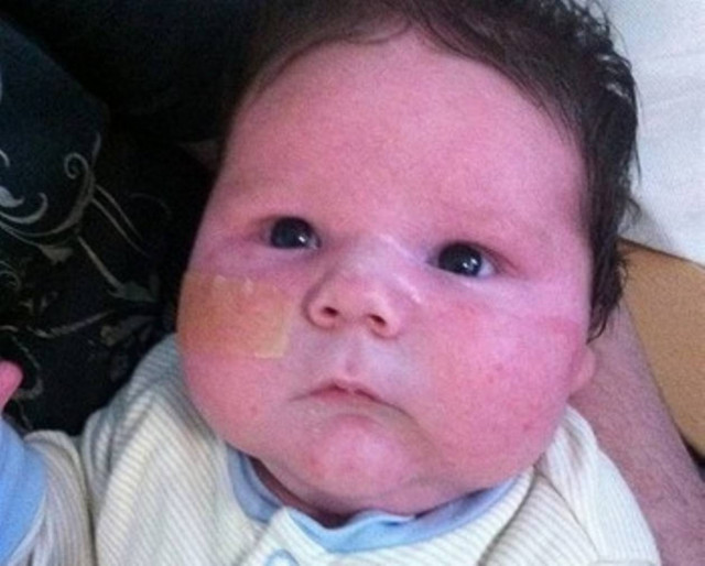 Απίστευτο: Γεννήθηκε μωρό–γίγας(pics)