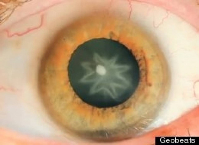 Δεν θα πιστεύετε τι έπαθε 9 μήνες μετά από τη γροθιά που δέχθηκε!