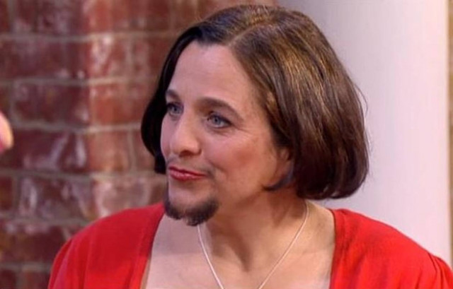 Δείτε πως είναι η γυναίκα με το… μούσι από τη Γερμανία! (pics)