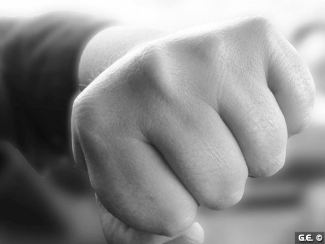 Πρέβεζα: Τη χτύπησε στη μέση του δρόμου