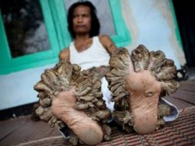 Αυτοί είναι οι 10 πιο άτυχοι άνθρωποι στον κόσμο!