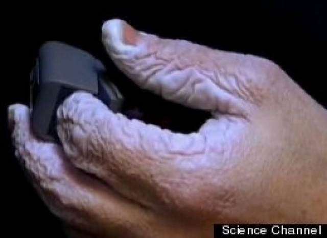 Βίντεο: Δείτε πως γίνεται το χέρι σας αν μείνετε 10 μέρες μέσα σε νερό