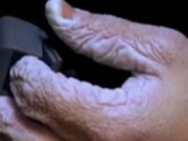 Δείτε πώς γίνεται το χέρι σας αν μείνετε 10 μέρες μέσα σε νερό (vid)