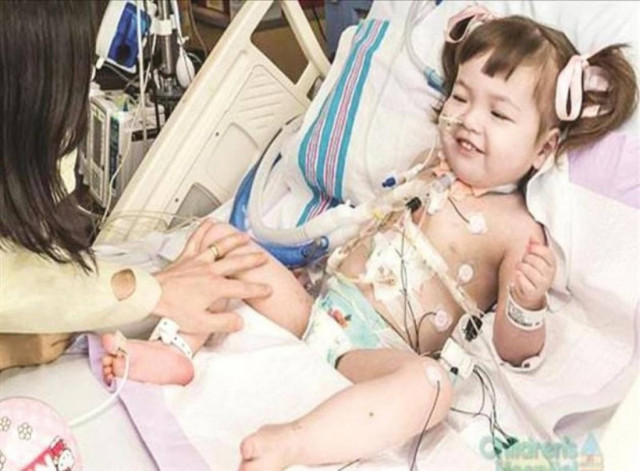 Πρώτη φορά μεταμόσχευση τραχείας σε 2χρονο κοριτσάκι