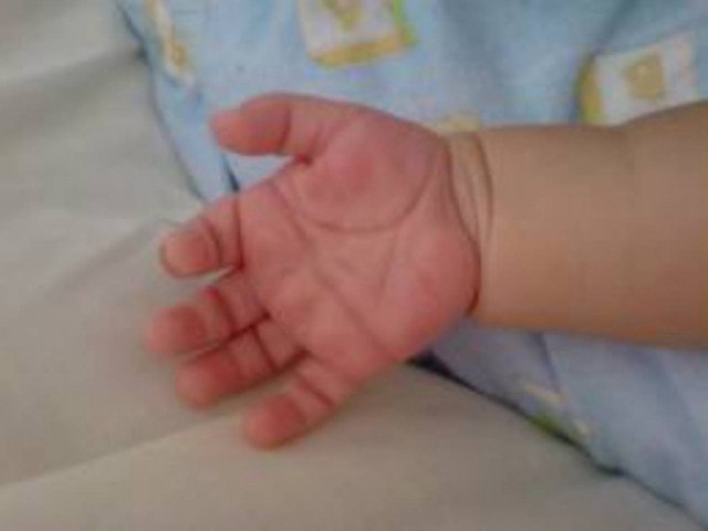 Κύμη: Αγωνία για 18 μηνών μωράκι - Κατάπιε μπαταρία