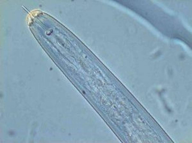 Τρία τέρατα που ζουν μέσα στο ανθρώπινο σώμα (pics)