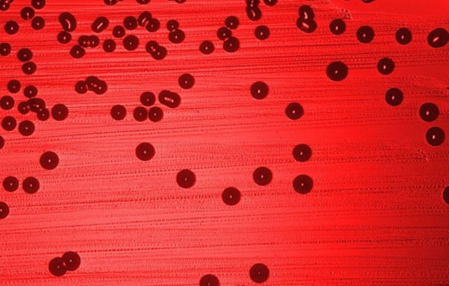 Φιλικοί ιοί vs εχθρικά βακτήρια