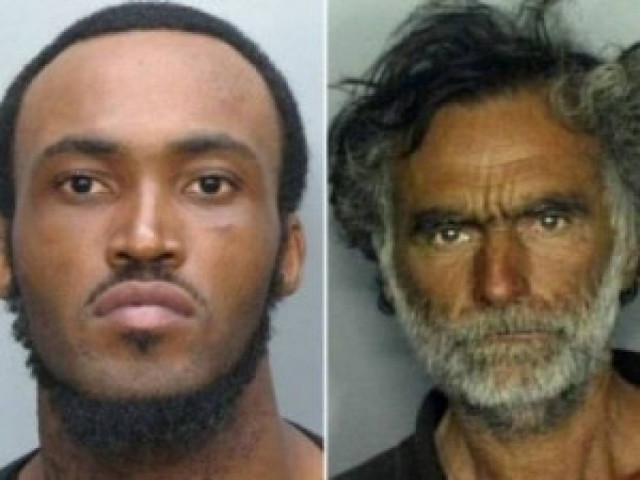 Εικόνες-ΣΟΚ: Το θύμα του κανίβαλου του Μαϊάμι έναν χρόνο μετά