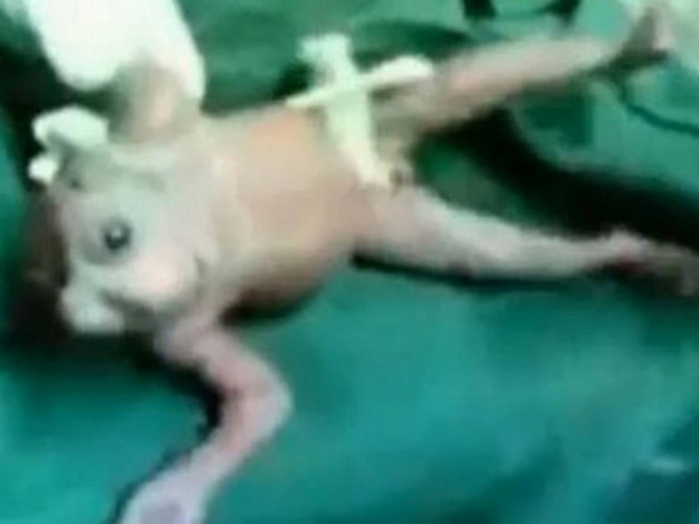 To ΣΟΚ των γιατρών! Γεννήθηκε μωρό-τέρας... (vid)