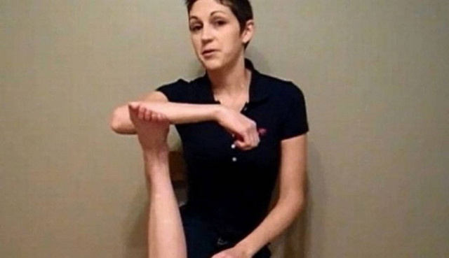 Επέζησε από τον καρκίνο και περιστρέφει το πόδι της κατά 180 μοίρες!