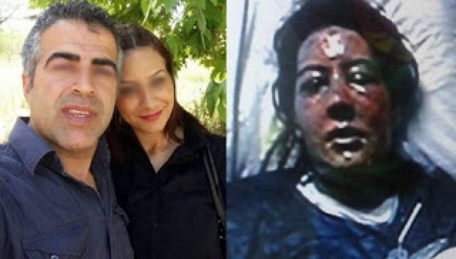 ΣΟΚ! Της έριξε από τη ζήλεια του βραστό νερό στο πρόσωπο