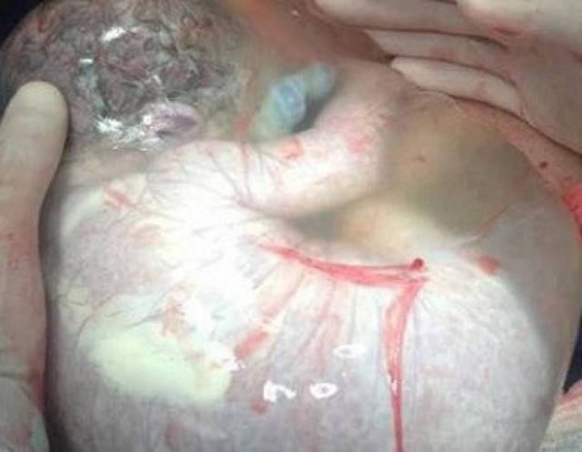 H σπάνια φώτο που σαρώνει: Μωρό γεννήθηκε στον αμνιακό του σάκο