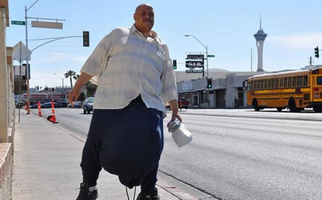 ΣΟΚ: Αφαίρεσε όρχι βάρους 45 κιλών!