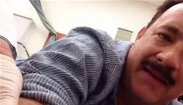 Δείτε:Ο Tom Hanks βιντεοσκοπεί την χειρουργική του επέμβαση (vid)