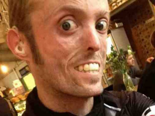 Σοκαριστικό: Ο άνθρωπος που δεν μπορεί να παχύνει