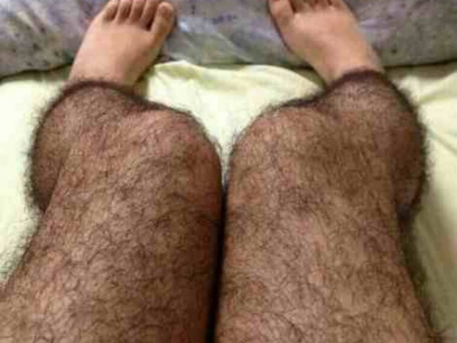 Απίστευτο: Βάζουν καλσόν με τρίχες για να μην...