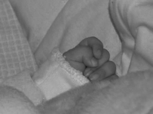 Αγοράκι γεννήθηκε με τέσσερα πόδια! (pic)