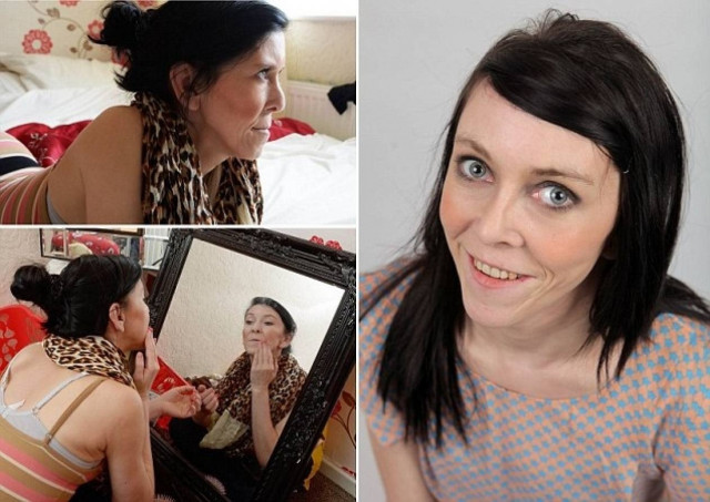 Είναι 16 ετών αλλά μοιάζει με 60 εξαιτίας μιας σπάνιας ασθένειας