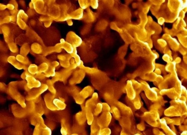 Τα μικρόβια θα μας… θάψουν όλους!