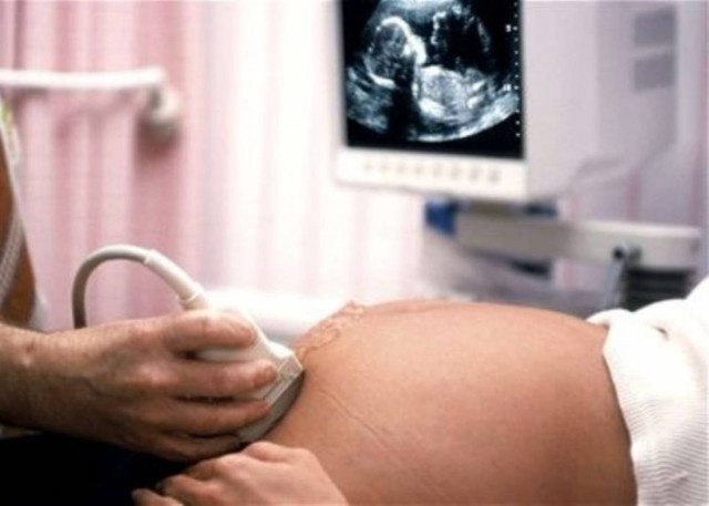 Tέξας: Απαγορεύτηκε η άμβλωση μετά τις 20 εβδομάδες