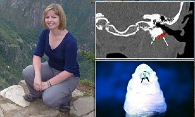 ΣΟΚ: Ανακάλυψε ζωντανά σκουλήκια μέσα στο κεφάλι της!