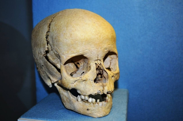 ΣΟΚ: Έκλεψε κρανία από νεκροταφείο και προσπάθησε να τα πουλήσει!