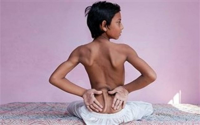 Δείτε: Το αγόρι με την «ουρά» (pics)