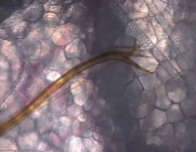 Δείτε τι συμβαίνει όταν μας τσιμπάει κουνούπι!