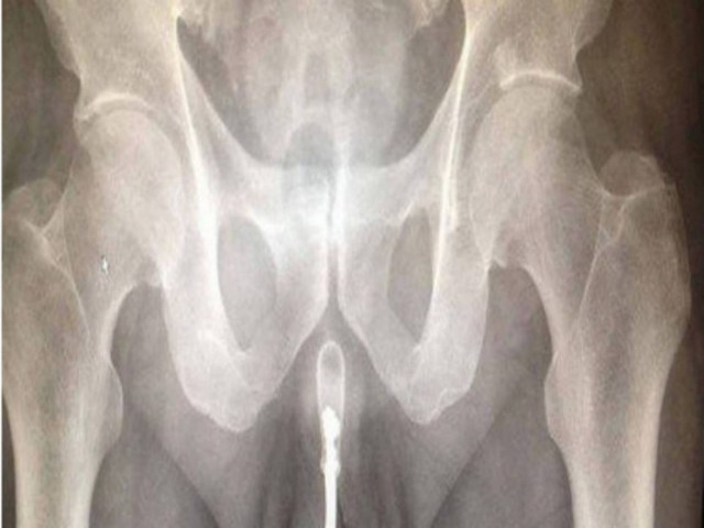 Απίστευτο: Δεν φαντάζεστε τι έβαλε στο πέος του για... απόλαυση!