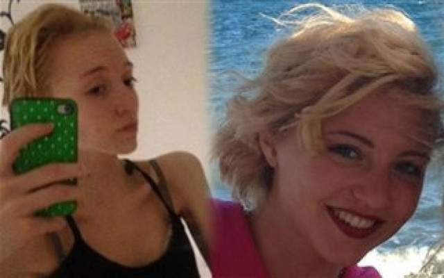 Συγκλονίζει η 17χρονη που πασχίζει να ξεπεράσει τη νευρική ανορεξία