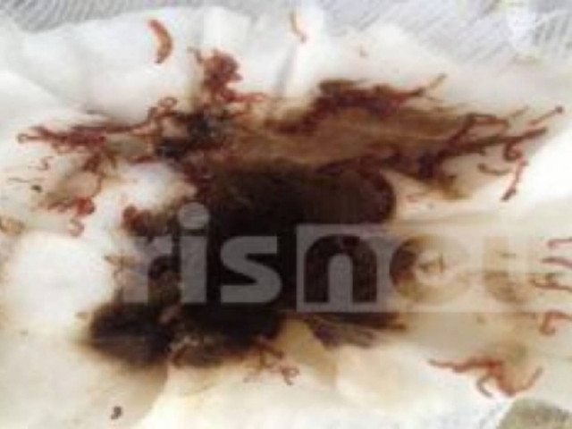 ΣΟΚ στη Μανωλάδα: Οι βρύσες...τρέχουν σκουλήκια (pic)