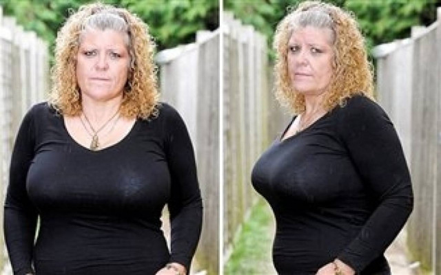 «Το στήθος μου μου έχει καταστρέψει τη ζωή»