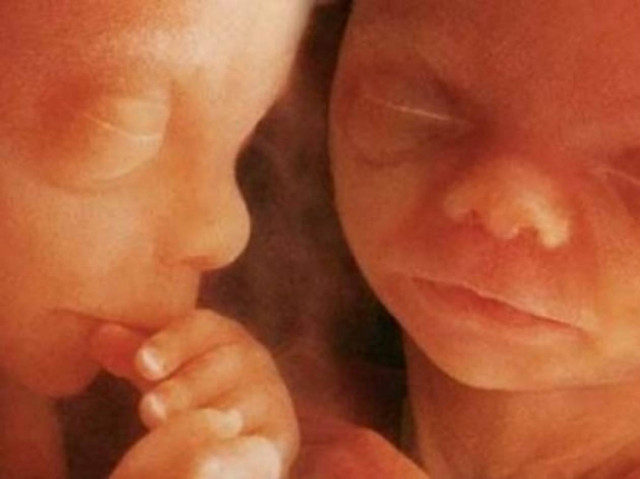 Το δράμα διδύμων που παντρεύτηκαν χωρίς να ξέρουν ότι είναι αδέλφια!