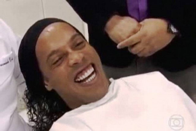 Απίστευτο κι όμως αληθινό: Έφτιαξε τα δόντια του ο Ροναλντίνιο