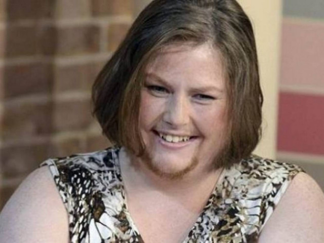 Η γυναίκα που αφήνει να της φυτρώσει μούσι επειδή...