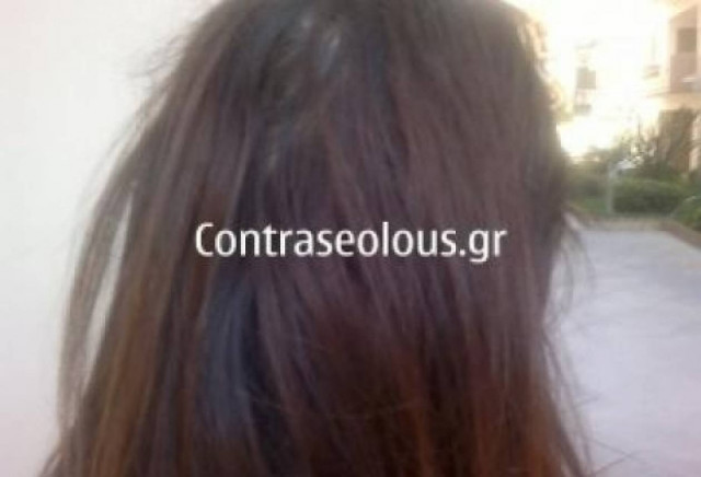 ΣΟΚ στην Πάτρα: Δεν της επιτρέπουν να βγει από το σπίτι επί 10 χρόνια