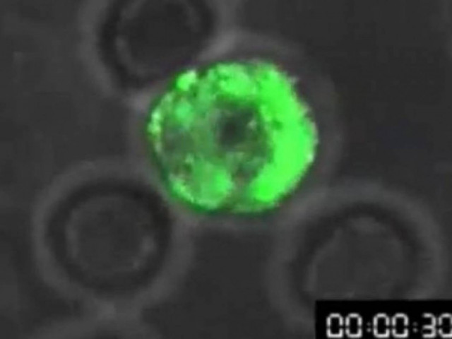 ΒΙΝΤΕΟ: Δείτε πως χτυπά το Aids τα ανθρώπινα κύτταρα