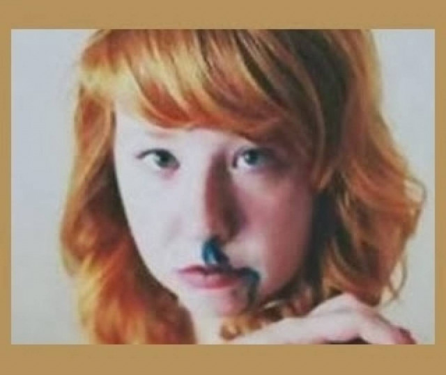 Πάνω από 7.000 άνθρωποι έχουν μπλε αίμα - Πώς εξηγείται;