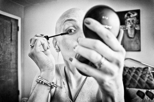 Συγκινητικό: Φωτογράφιζε τη γυναίκα του σε όλα τα στάδια του καρκίνου