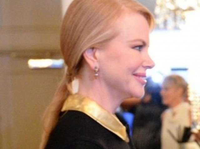Nicole Kidman: Πέτρωσε το πρόσωπό της από το Botox