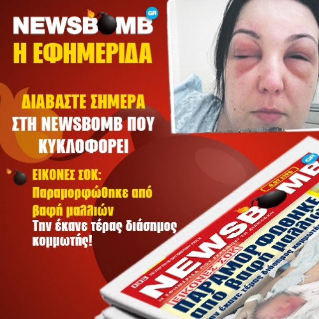 ΕΙΚΟΝΕΣ ΣΟΚ: Παραμορφώθηκε από βαφή μαλλιών