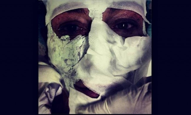 Με γάζες στο πρόσωπο Έλληνας σχεδιαστής