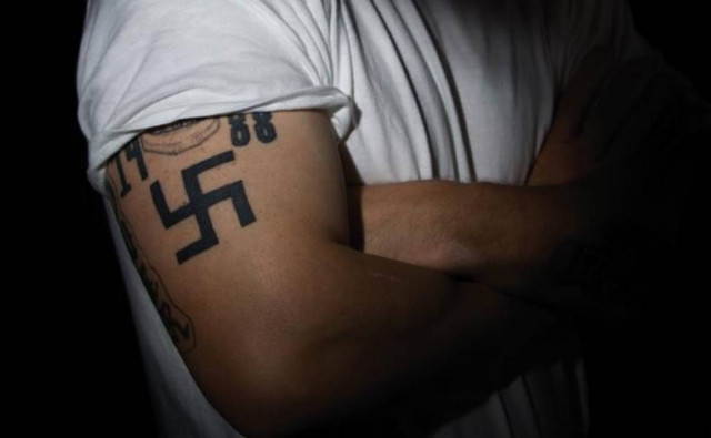 Τα τατουάζ της Χρυσής Αυγής – πώς τα σβήνουν οι δερματολόγοι