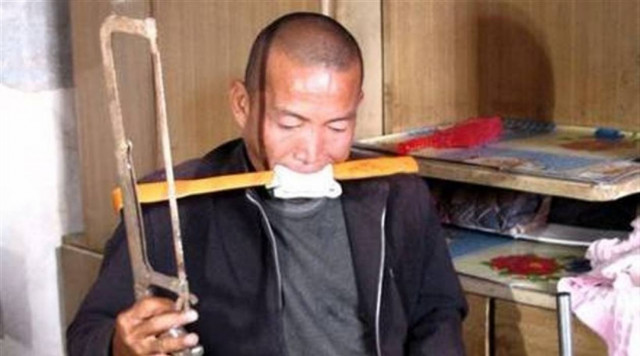 Ακρωτηρίασε το πόδι του με πριόνι για να γλιτώσει τα ιατρικά έξοδα