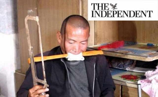 Ακρωτηρίασε το πόδι του με πριόνι γιατί δεν είχε χρήματα