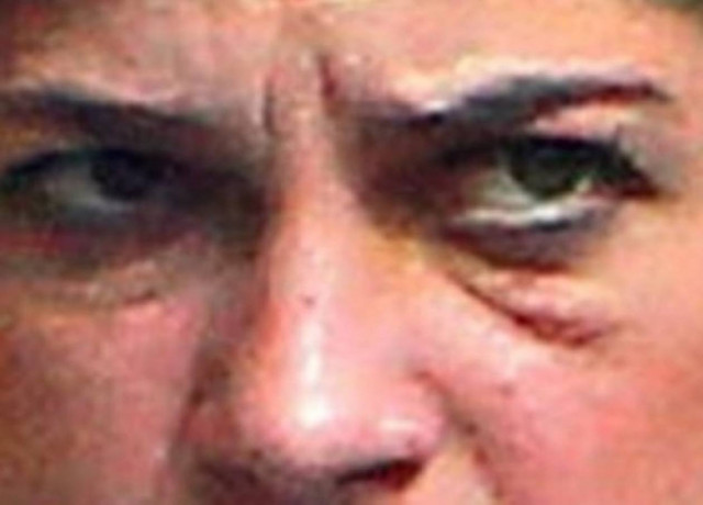Ποια διάσημη ηθοποιός εμφανίστηκε με... μαυρισμένο μάτι;