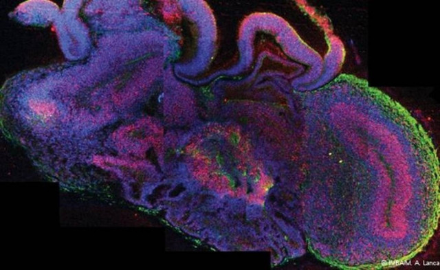 Κατασκεύασαν μίνι εγκεφάλους από βλαστοκύτταρα!