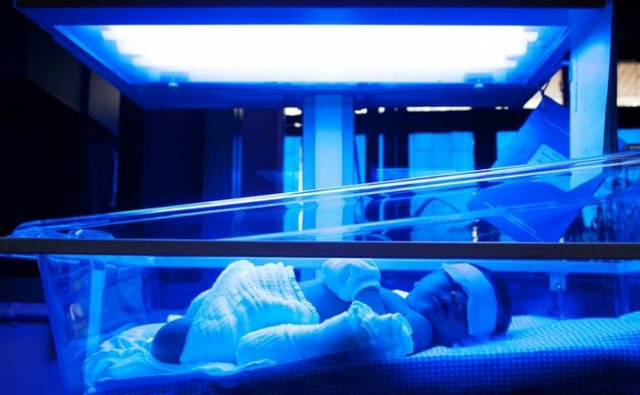 Επιστήμονες κατασκεύασαν "έξυπνα" ρούχα για πρόωρα μωρά - VIDEO