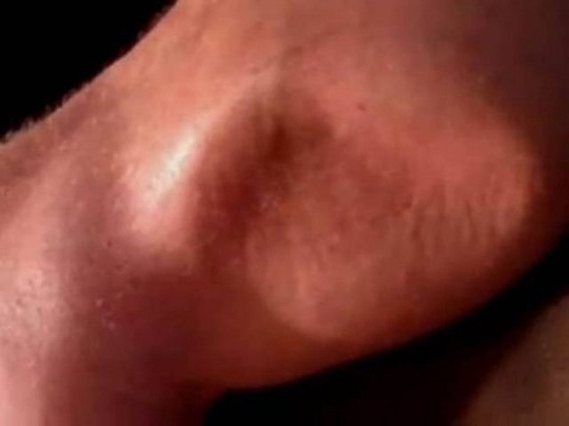 Βίντεο: Κράμπα βγαλμένη απο εφιάλτη!